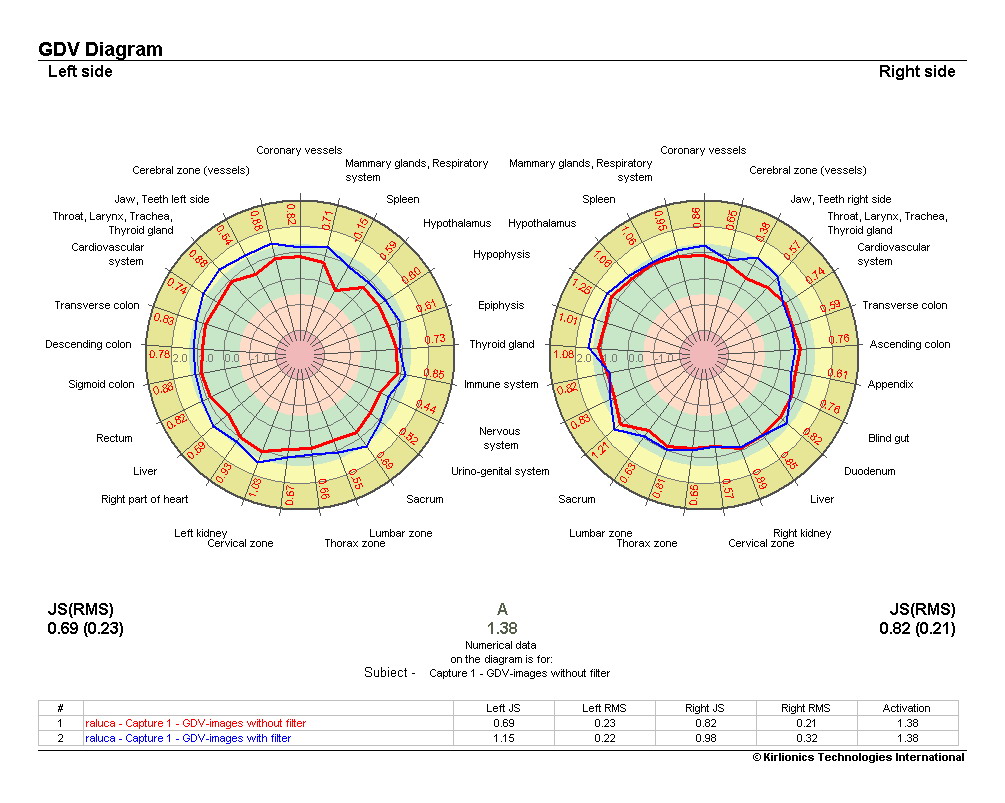 diagrama